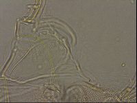 Testechiniscus laterculus image