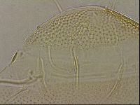 Testechiniscus laterculus image