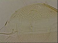 Testechiniscus laterculus image