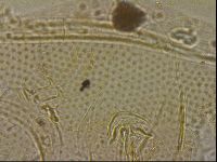 Testechiniscus laterculus image