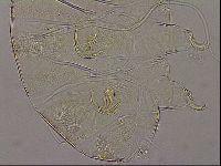 Testechiniscus laterculus image