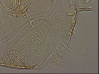 Testechiniscus laterculus image
