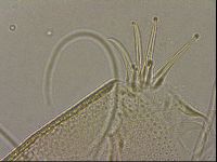 Testechiniscus laterculus image