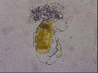 Echiniscus mediantus image