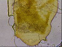 Echiniscus mediantus image
