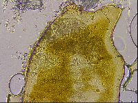 Echiniscus mediantus image
