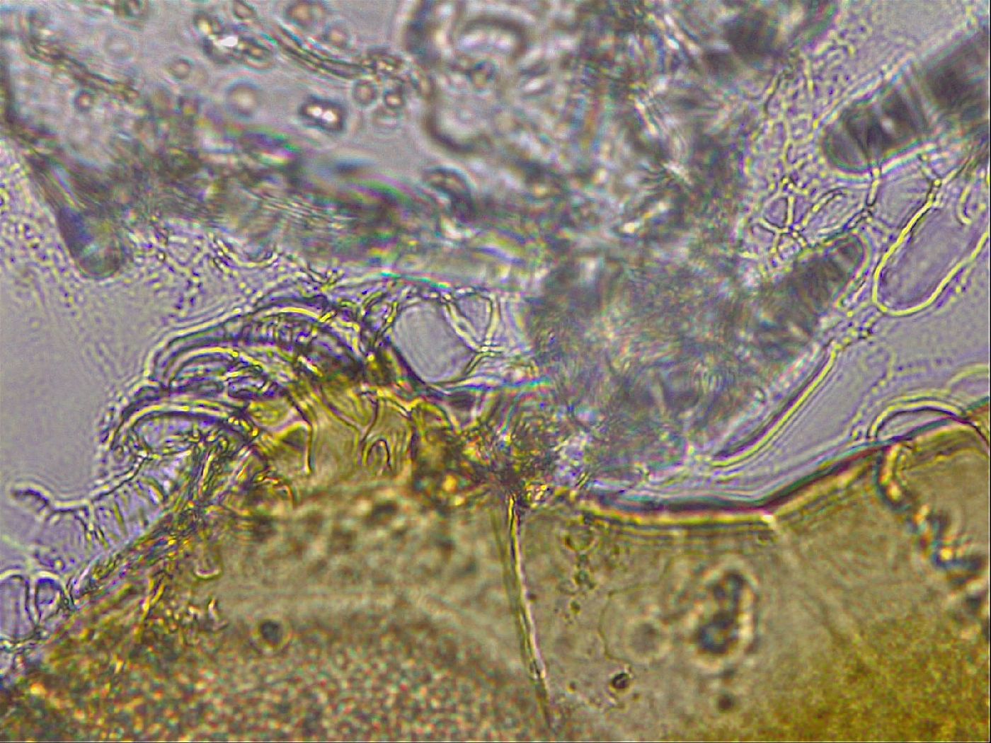 Echiniscus mediantus image