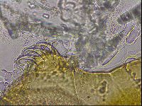 Echiniscus mediantus image