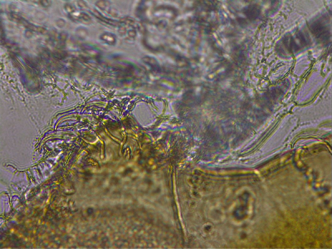 Echiniscus mediantus image