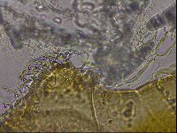Echiniscus mediantus image