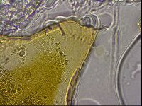 Echiniscus mediantus image