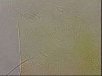 Echiniscus wendti image