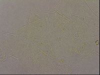Echiniscus merokensis image