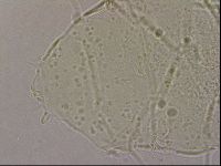 Echiniscus merokensis suecicus image