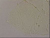 Echiniscus merokensis suecicus image