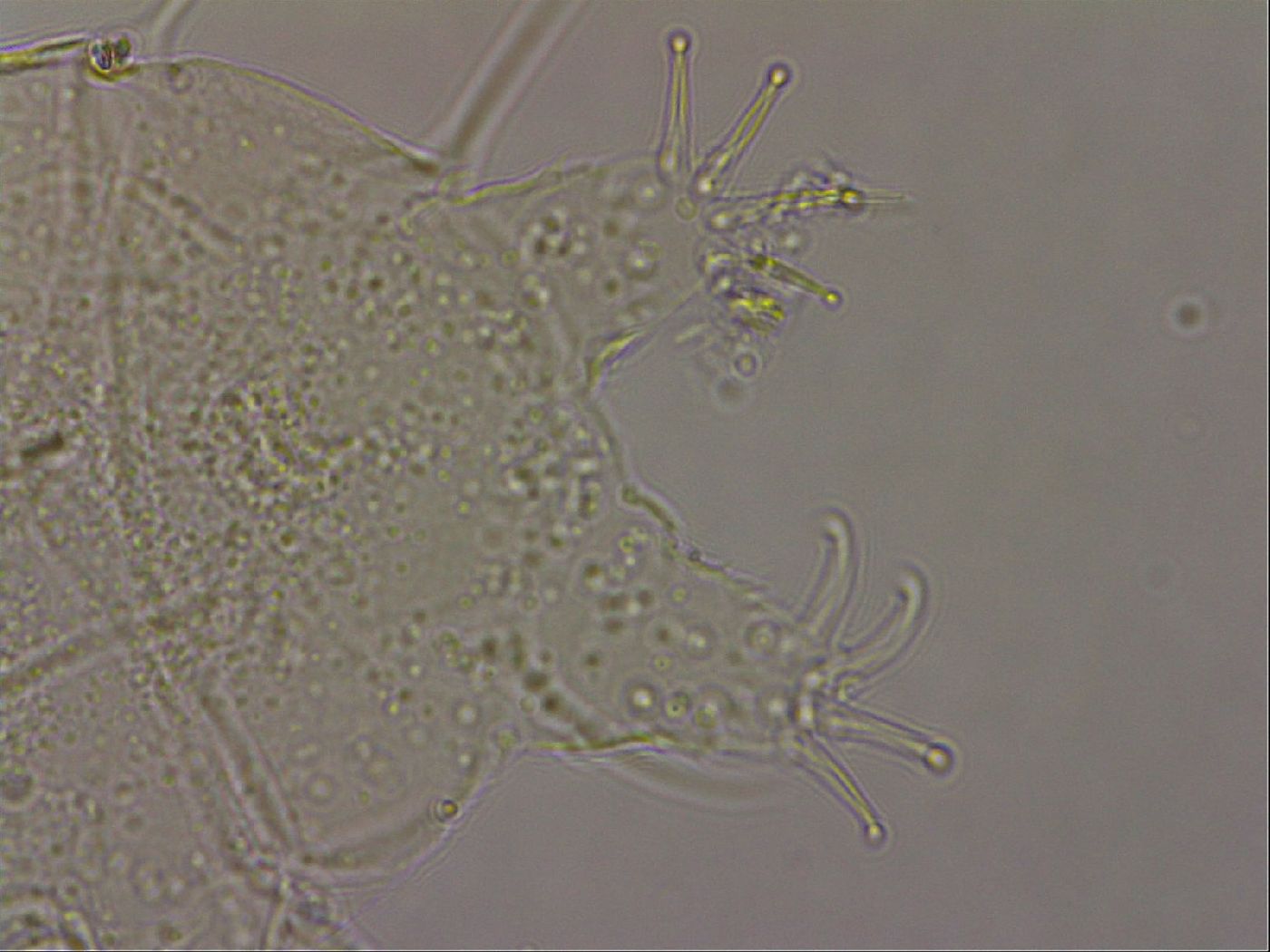 Echiniscus merokensis suecicus image