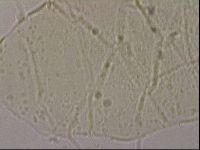 Echiniscus merokensis suecicus image