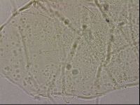 Echiniscus merokensis suecicus image