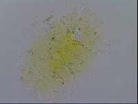 Echiniscus merokensis image
