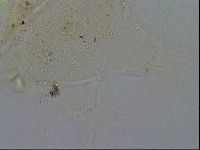 Echiniscus merokensis image