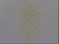 Echiniscus merokensis image