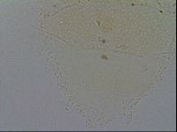 Echiniscus merokensis image
