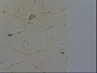 Echiniscus merokensis image