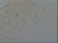 Echiniscus merokensis image