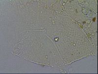 Echiniscus merokensis image