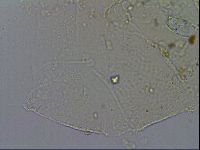 Echiniscus merokensis image