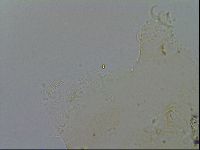 Echiniscus merokensis image