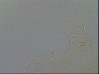 Echiniscus merokensis image