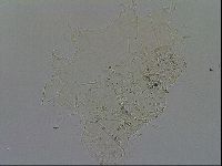 Echiniscus merokensis image