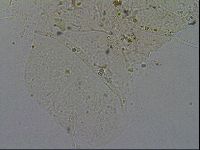 Echiniscus merokensis image