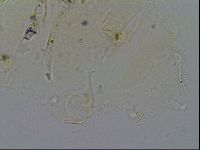 Echiniscus merokensis image