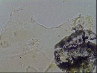 Echiniscus merokensis image