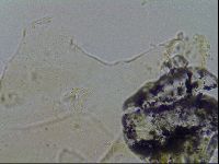 Echiniscus merokensis image