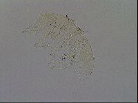 Echiniscus merokensis image