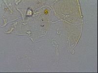 Media resource of Echiniscus merokensis