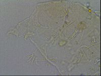 Echiniscus merokensis image