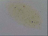 Echiniscus merokensis image