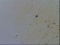 Echiniscus merokensis image