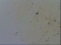 Echiniscus merokensis image