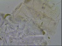Echiniscus merokensis image