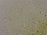 Echiniscus merokensis image
