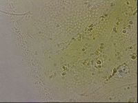 Echiniscus merokensis image