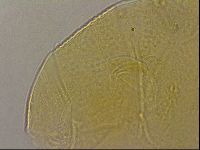 Echiniscus merokensis image
