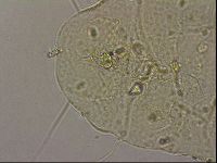 Echiniscus merokensis image