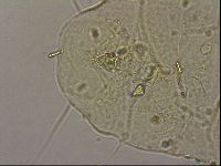 Echiniscus merokensis image
