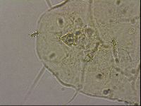 Echiniscus merokensis image
